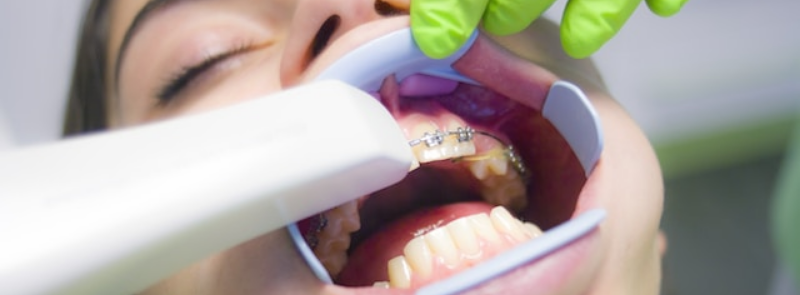National Children Dental Health Month