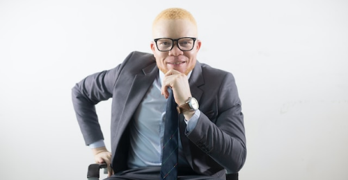 International Albinism Awareness Day