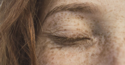 International Skin Pigmentation Day